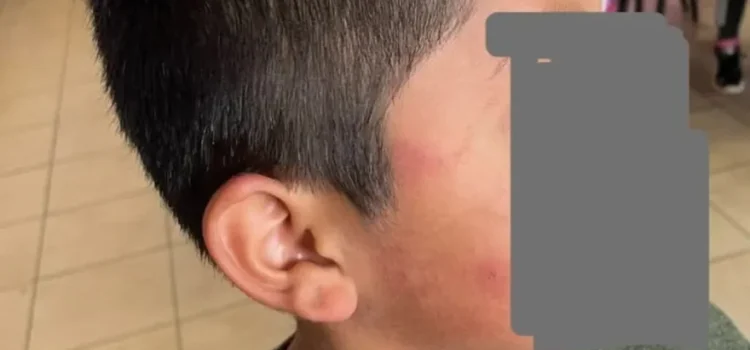 Suspenden clases en primarias de Tlaquilpa por contagio masivo con el virus Coxsackie