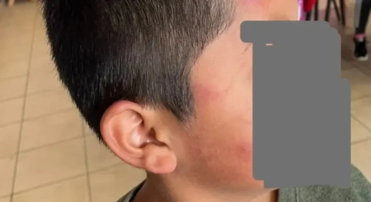 Suspenden clases en primarias de Tlaquilpa por contagio masivo con el virus Coxsackie